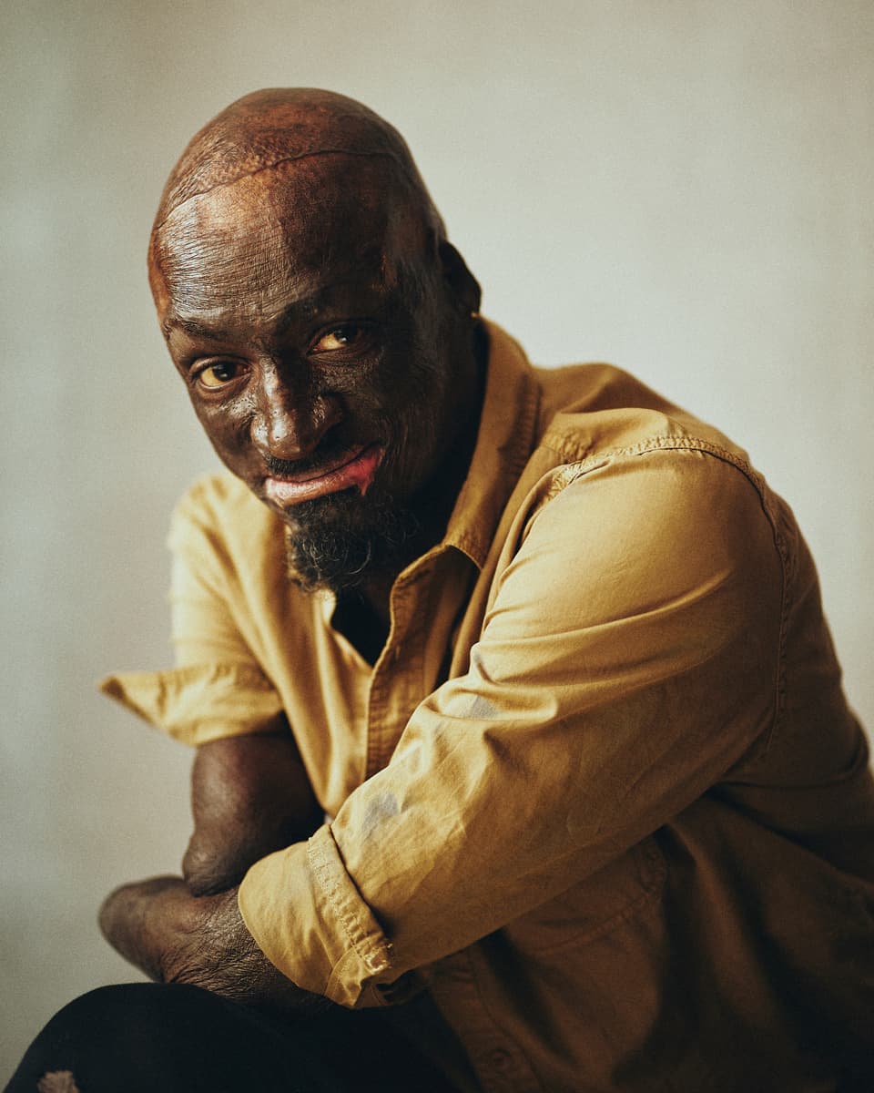 Toronto theatre actor editorial headshot of a man with vitiligo wearing a mustard yellow button-up shirt, leaning forward with arms folded and a warm engaging smile against a soft off-white background